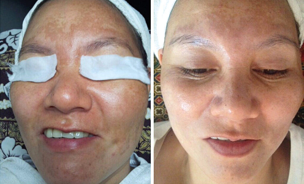 Ingredienti e veicoli naturali nella cosmesi dermatologica